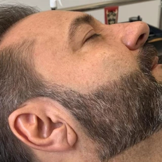 Full Barba (Micropigmentação de Barba)