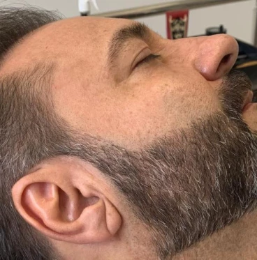 Imagem Full Barba (Micropigmentação de Barba)